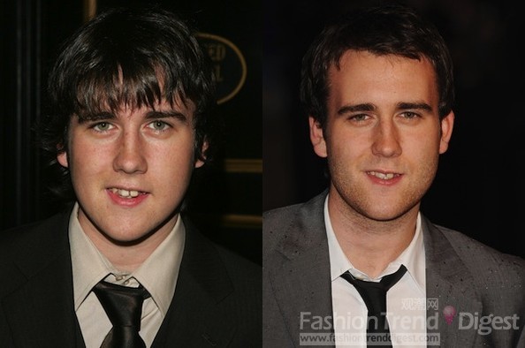 10. 馬修•路易斯(Matthew Lewis): 飾演Neville Longbottom（納威•隆巴頓）<br>
馬修•路易斯自五歲加入一家業余戲劇俱樂部后便開始表演。他在參加了位于他家鄉利茲城的一次海選后贏得了出演納威的機會。不過他外戴假牙和兩個不一樣大的鞋子，讓觀眾印象更為深刻。現在的他成熟了許多，看起來有點邪像。<br>
 