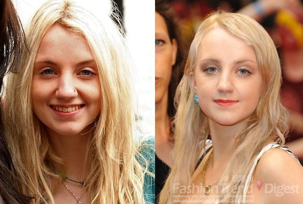 11. 伊文娜•林奇(Evanna Lynch): 飾演Luna Lovegood（盧娜•麗夫古德）<br>
伊文娜•林奇（Evanna Lynch）是一位愛爾蘭女演員，因演出《哈利•波特》電影系列中盧娜•沃夫古德(Luna Lovegood)一角而聞名。只有14歲的她為了參加《哈利•波特與鳳凰社》中盧娜演員的競選，特地從飛機飛到倫敦面試，擊敗了15000個女孩成功地擔任這一角色，現在19歲的她變得更加美麗，業余時間會做一些模特和慈善工作。<br>
 